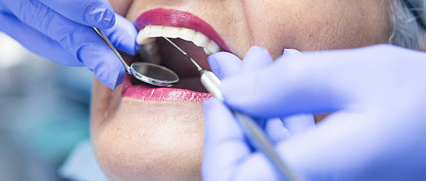 Best Emergency Tooth Extraction in Post Falls, ID